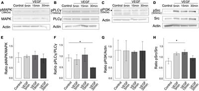 VEGF controls microglial phagocytic response to amyloid-β